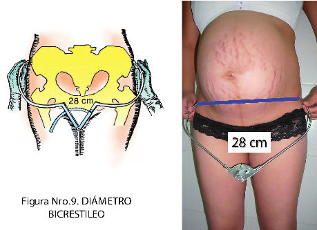 Archivos Bolivianos de Medicina DESCRIPCIÓN ANATÓMICA DE LA PELVIS OBSTÉTRICA Y EXAMEN